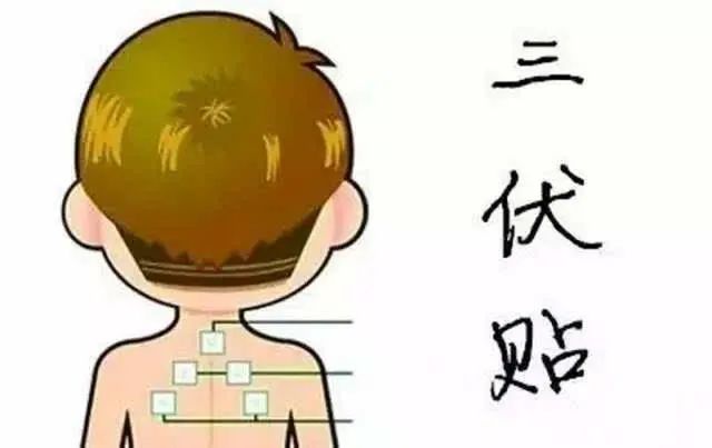 1、“兒童三伏貼”能讓孩子少生病嗎？爸爸媽媽不再盲目跟風了。