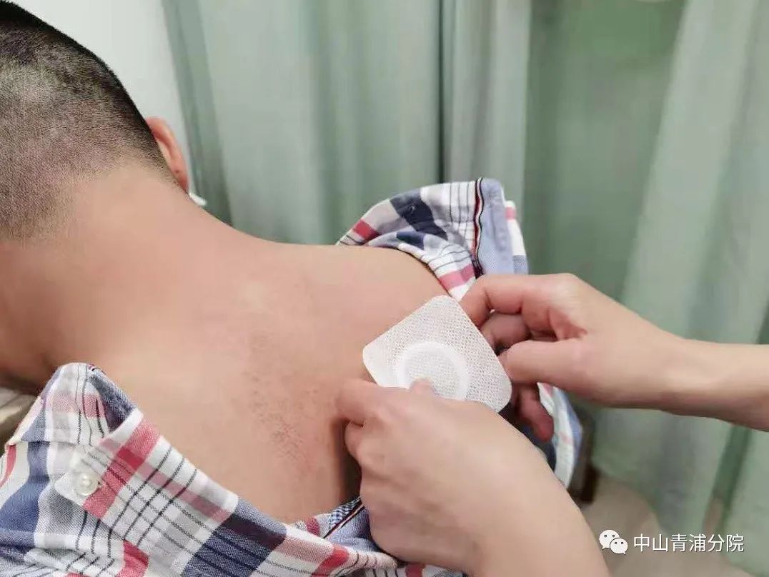 2、江西兒童貼三伏貼癢灼痛，什么體質(zhì)的人可以貼三伏貼癢灼痛？