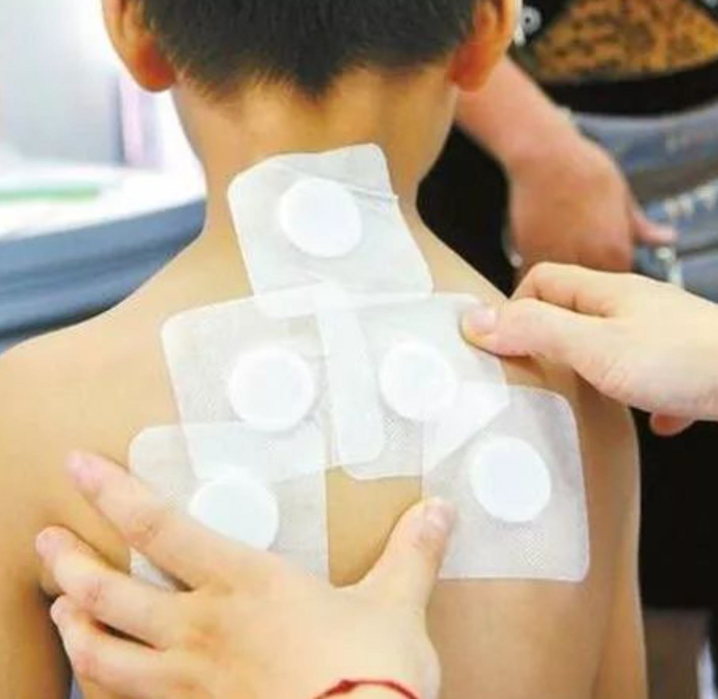 2、三伏貼在脖子上，有一根針，看起來很疼。怎么了